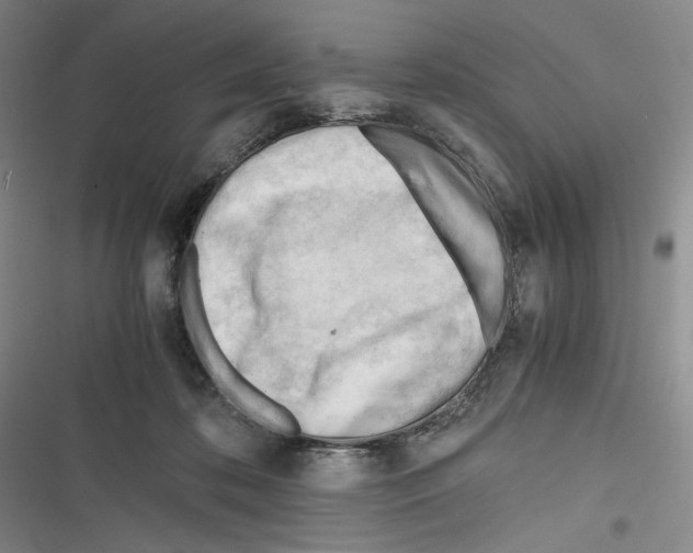 X0000116260316201001110959