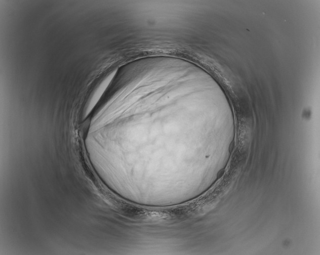 X0000116260585201001110955