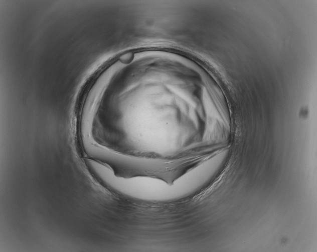 X0000116261414201001110944