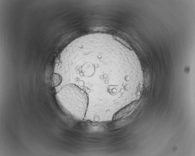 X0000116270175201001111022