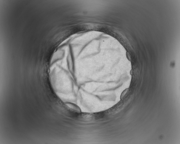 X0000116270325201001111020