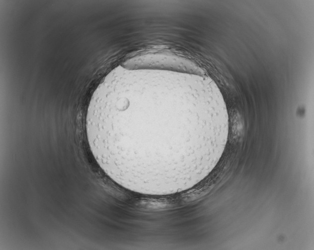 X0000116270559201001111017