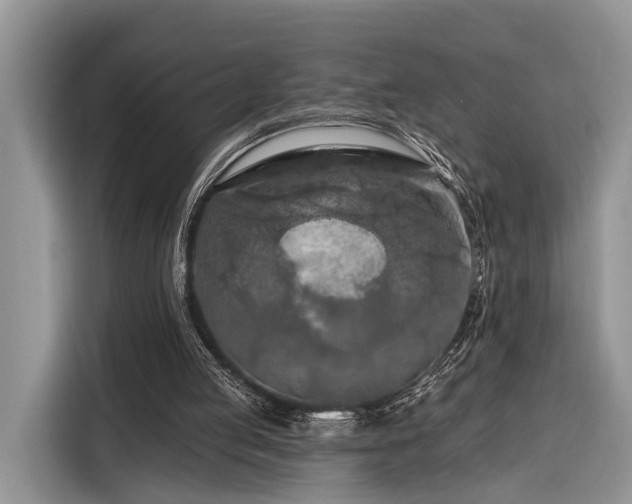 X0000116280053200912071158