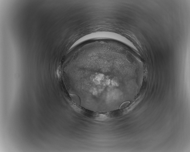 X0000116280285200912071156