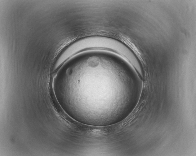 X0000116280058200912141357