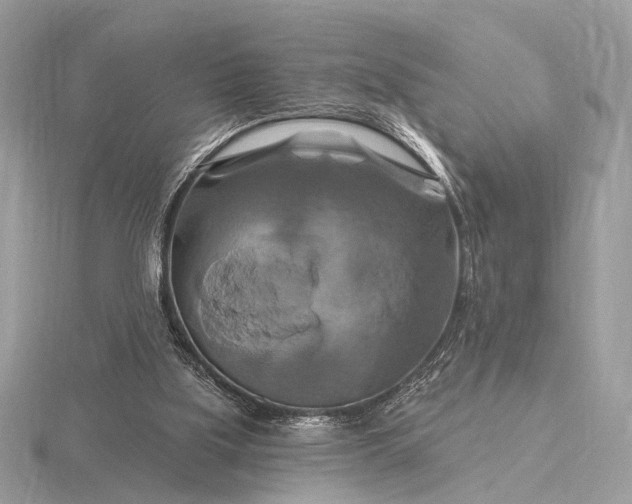 X0000116280059200912141357