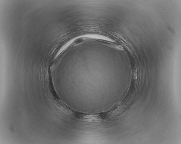 X0000116280516200912141351