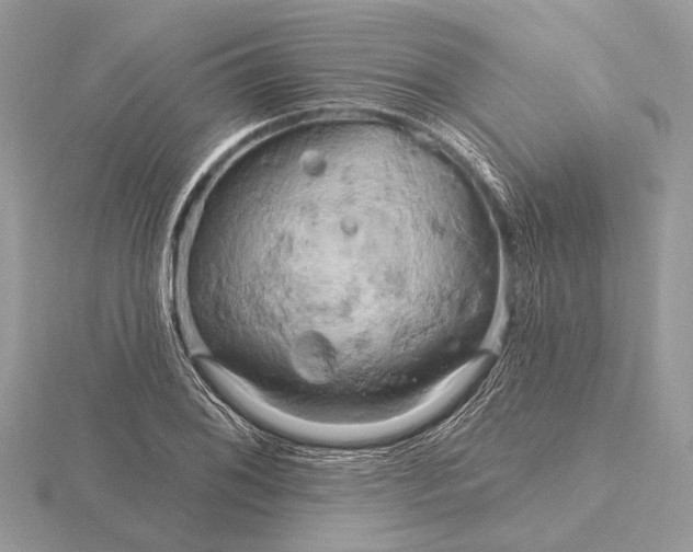 X0000116281076200912141344