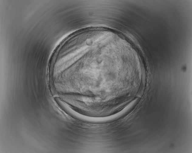 X0000116281076200912211814