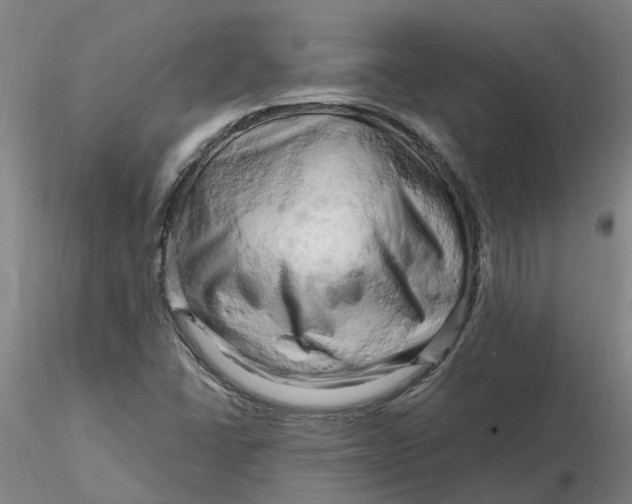 X0000116281406200912211809