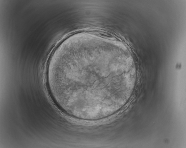 X0000116280002201001111045