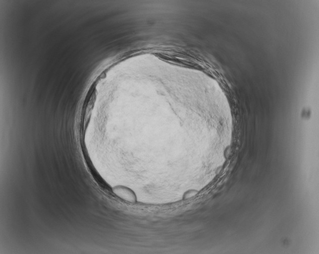 X0000116280003201001111045