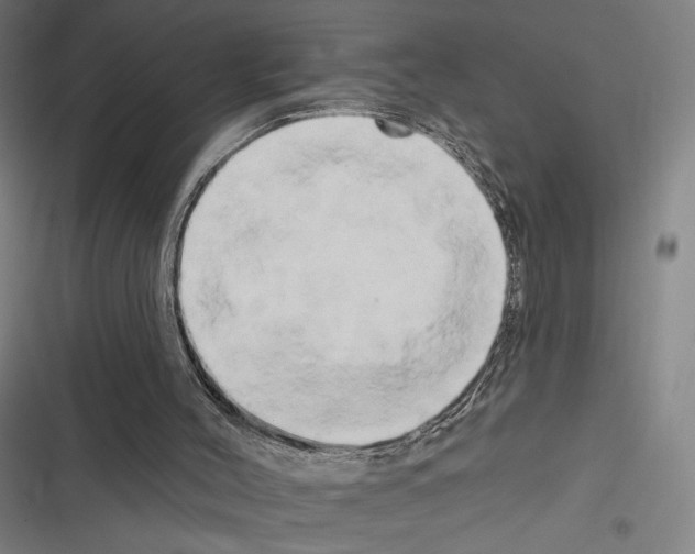X0000116280004201001111045