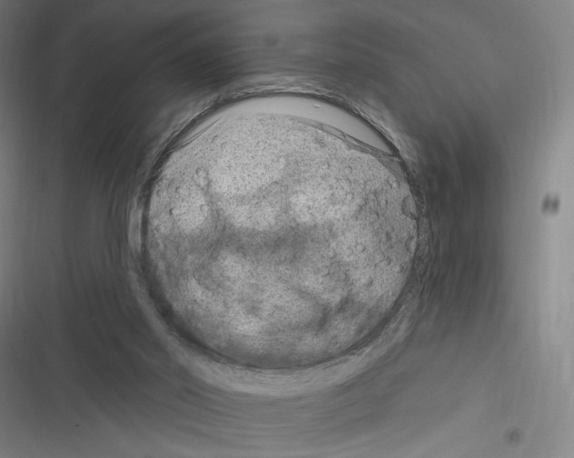X0000116280014201001111045