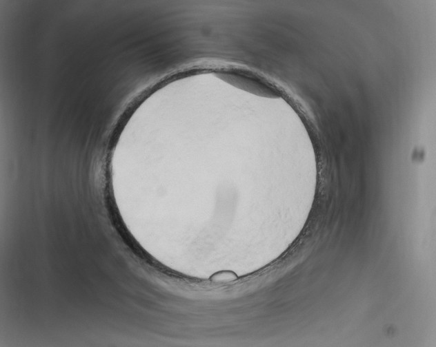 X0000116280015201001111045
