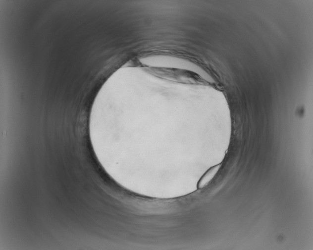 X0000116280036201001111045