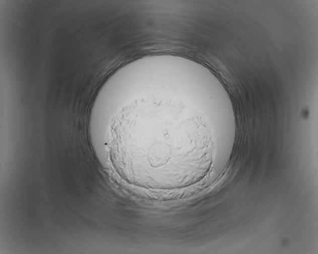 X0000116280045201001111045