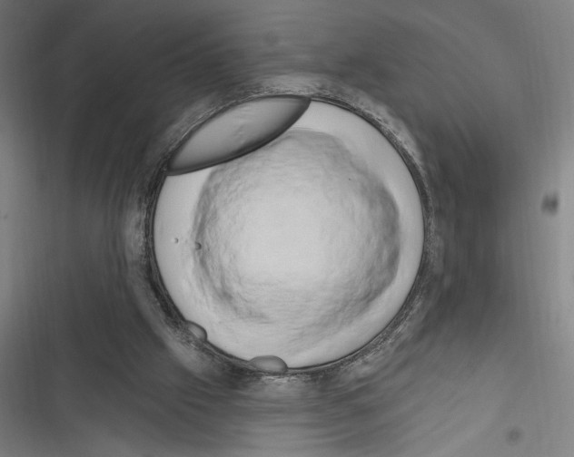 X0000116280057201001111044