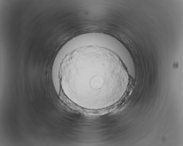 X0000116280096201001111044