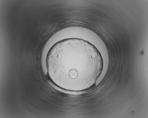 X0000116280135201001111043