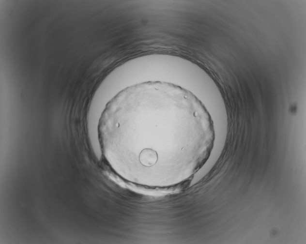 X0000116280137201001111043