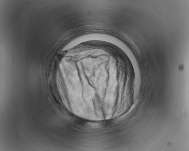 X0000116280170201001111043