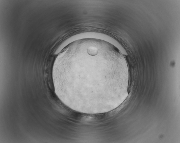 X0000116280174201001111043