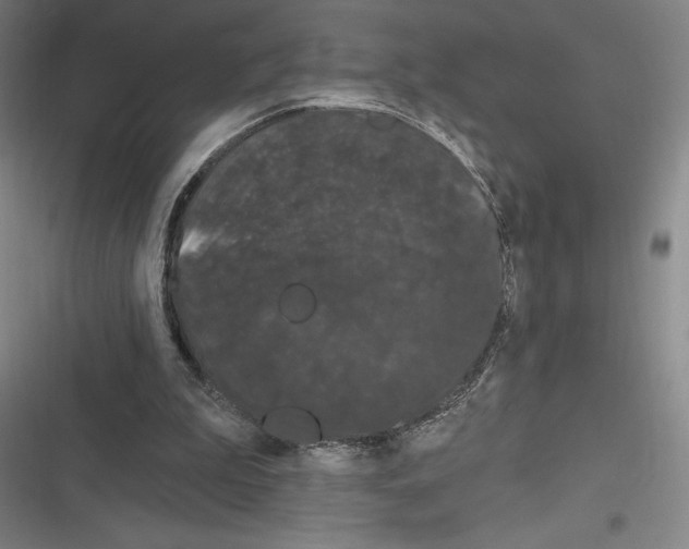 X0000116280199201001111042