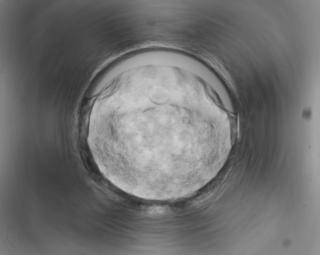 X0000116280204201001111042