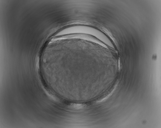 X0000116280205201001111042