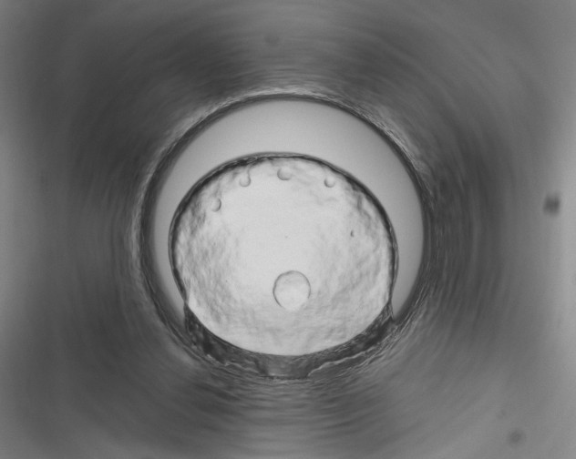X0000116280252201001111041