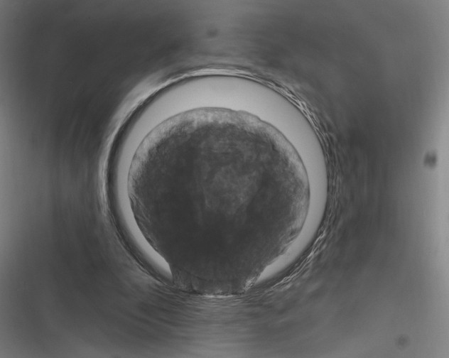 X0000116280296201001111041