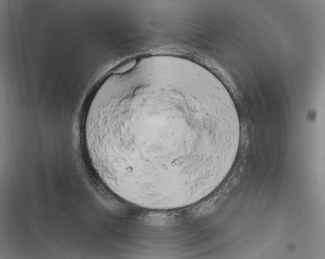 X0000116280298201001111041