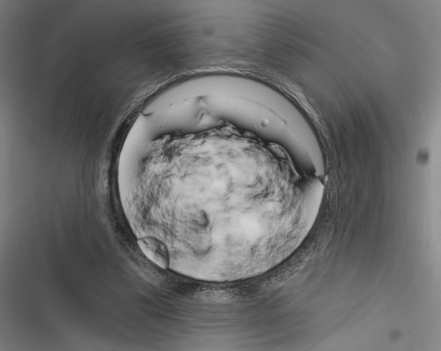 X0000116280299201001111041