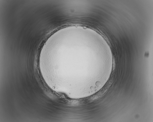 X0000116280301201001111041
