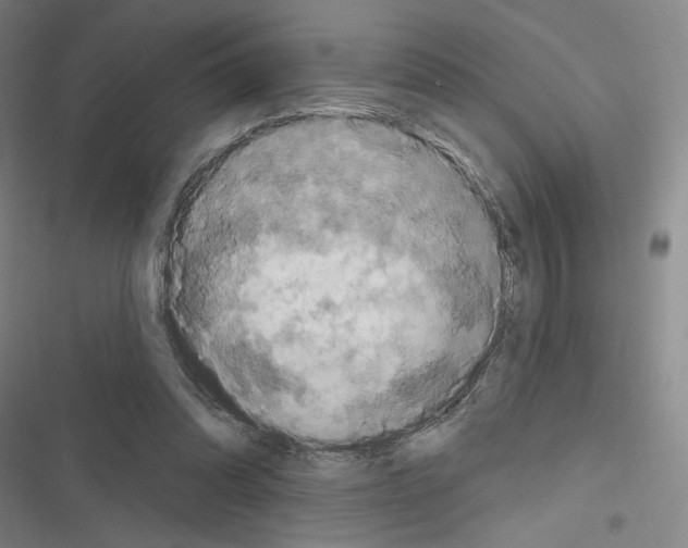 X0000116280302201001111041