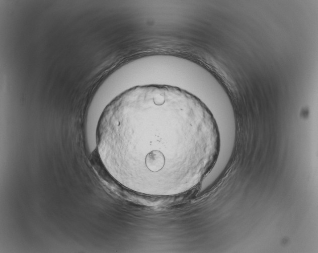 X0000116280313201001111041