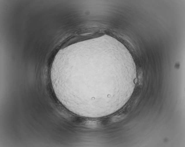 X0000116280314201001111041
