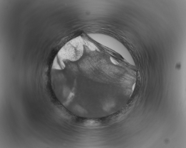 X0000116280319201001111041