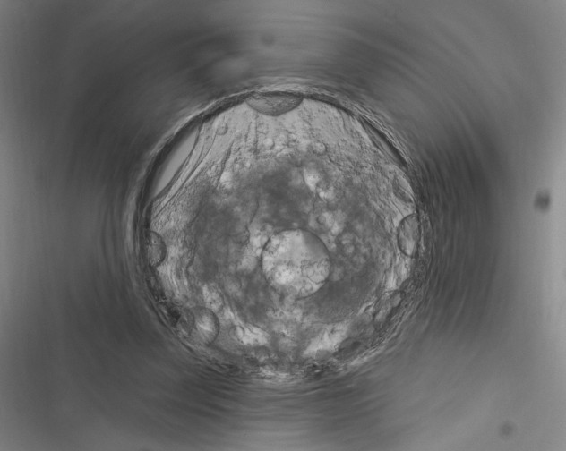 X0000116280347201001111040