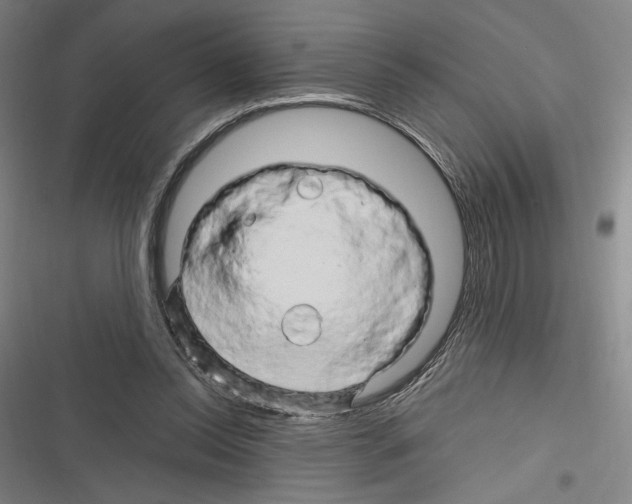 X0000116280350201001111040