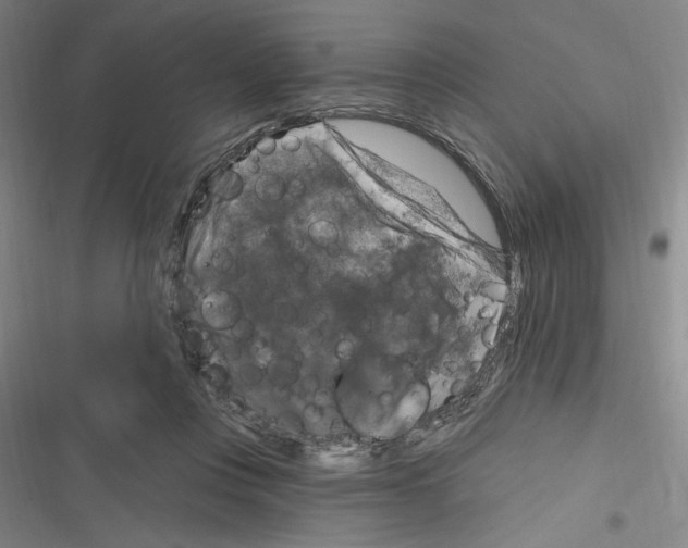 X0000116280359201001111040