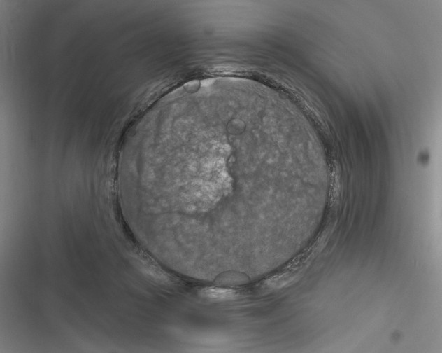 X0000116280361201001111040