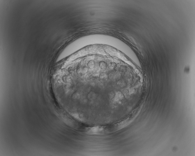 X0000116280366201001111040