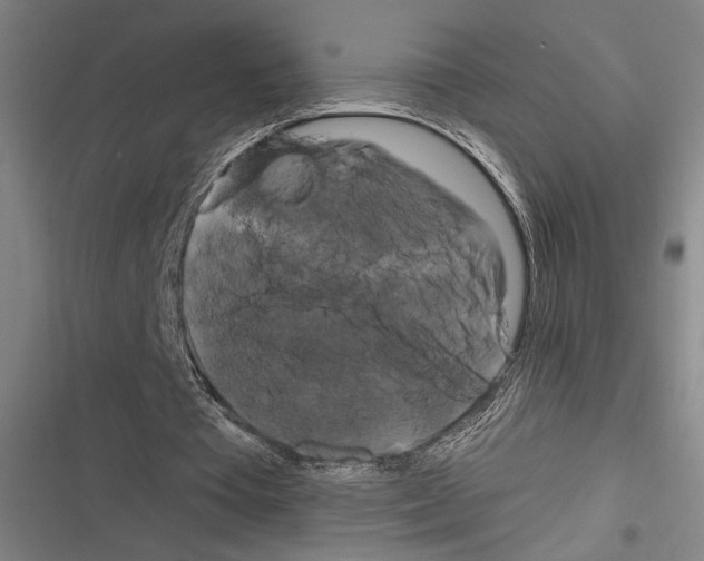 X0000116280385201001111040