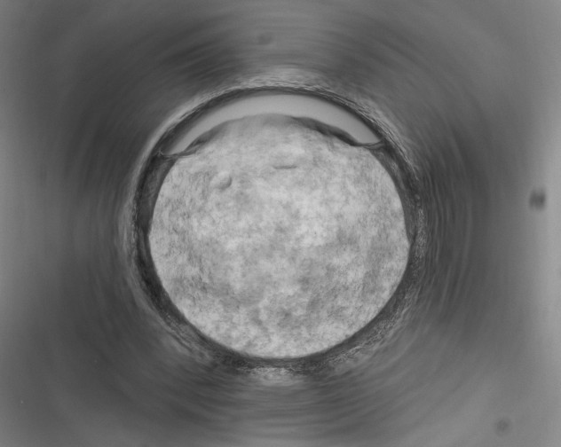 X0000116280392201001111040