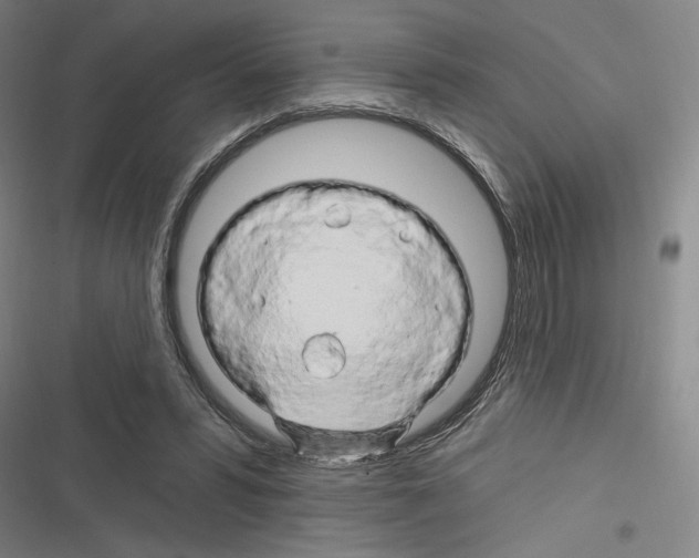 X0000116280399201001111039