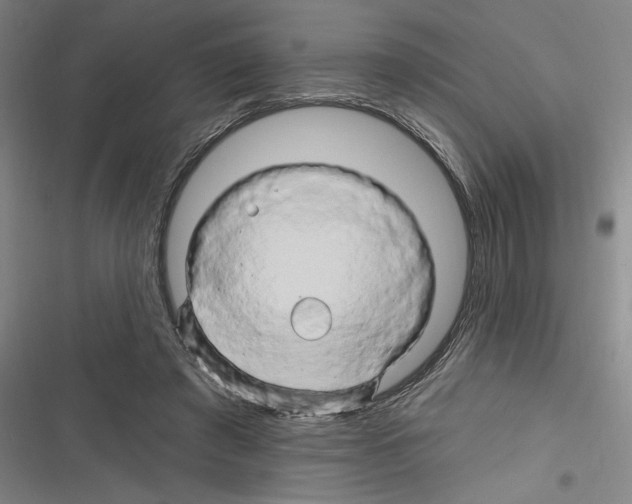 X0000116280401201001111039