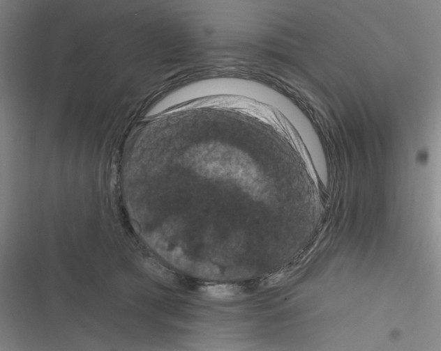 X0000116280417201001111039