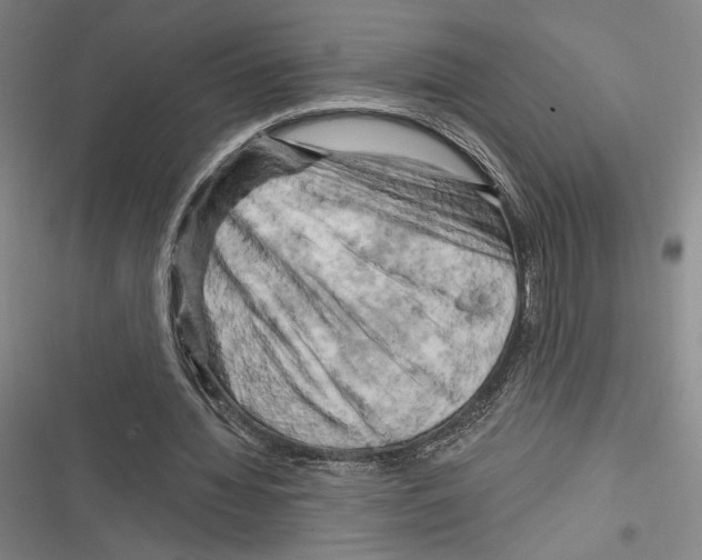 X0000116280436201001111038